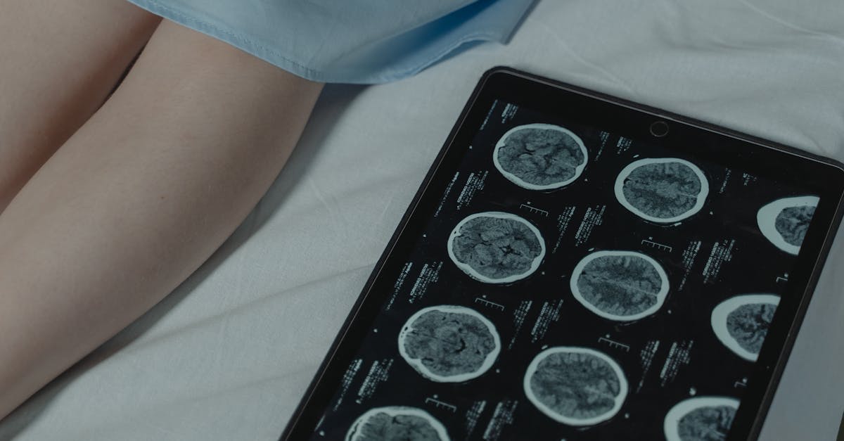 découvrez les méthodes avancées et les technologies innovantes pour un diagnostic précis des maladies, afin d'améliorer la prise en charge et le traitement des patients.